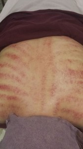 Gua Sha 3